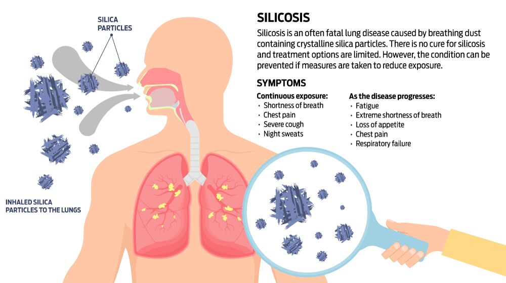 What You Need To Know About Magnesite Floors 16 The Dangers Of Silica Dust 2